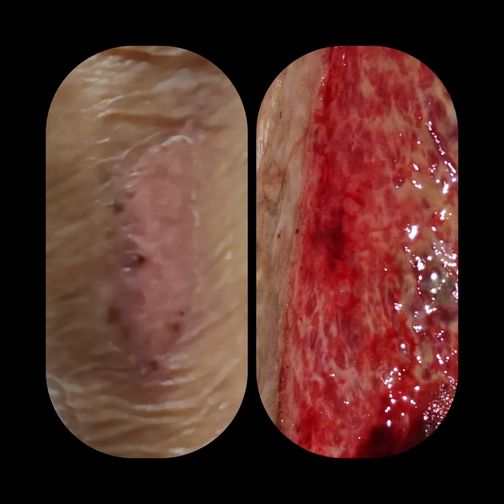 Manejo de lesión cutánea — evolución del tratamiento.